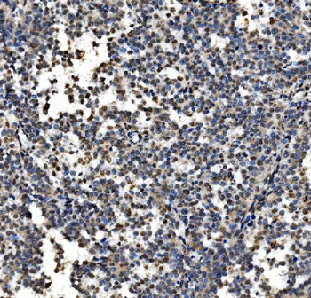 CDC27 Rabbit Polyclonal Antibody