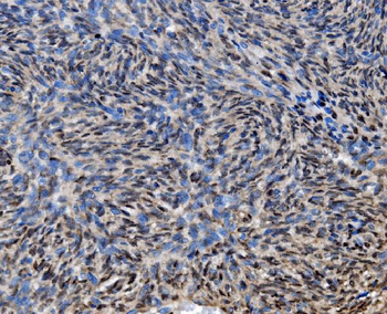 CDC27 Rabbit Polyclonal Antibody