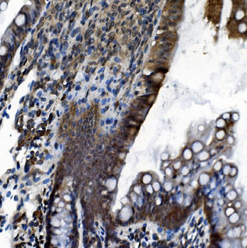 CDC27 Rabbit Polyclonal Antibody