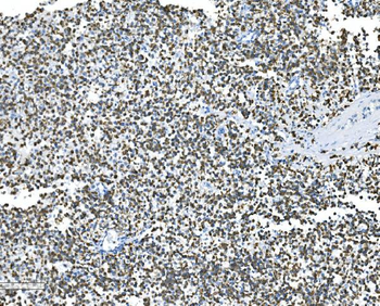 Glycine decarboxylase/GLDC Rabbit Polyclonal Antibody