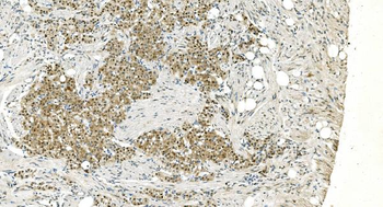 LSM5 Rabbit Polyclonal Antibody