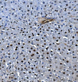 LSM5 Rabbit Polyclonal Antibody