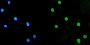 LSM5 Rabbit Polyclonal Antibody