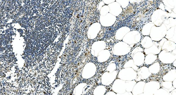 LSM5 Rabbit Polyclonal Antibody