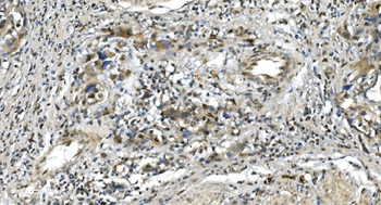 LSM5 Rabbit Polyclonal Antibody