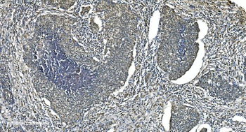 LSM5 Rabbit Polyclonal Antibody