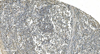 LSM5 Rabbit Polyclonal Antibody