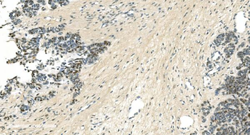LSM5 Rabbit Polyclonal Antibody