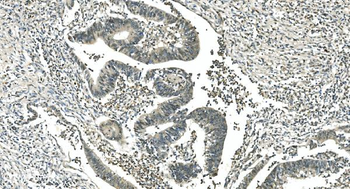 LSM5 Rabbit Polyclonal Antibody