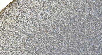 LSM7 Rabbit Polyclonal Antibody