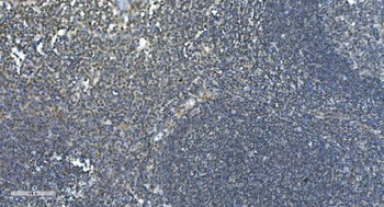 LSM7 Rabbit Polyclonal Antibody