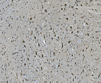 LSM7 Rabbit Polyclonal Antibody