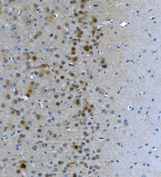 LSM7 Rabbit Polyclonal Antibody