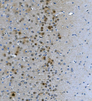 LSM7 Rabbit Polyclonal Antibody
