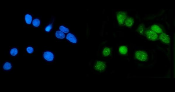 LSM7 Rabbit Polyclonal Antibody