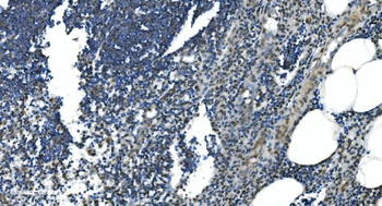 LSM7 Rabbit Polyclonal Antibody