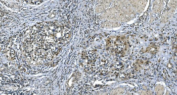 LSM7 Rabbit Polyclonal Antibody