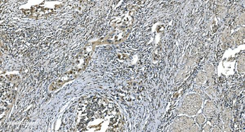 LSM7 Rabbit Polyclonal Antibody