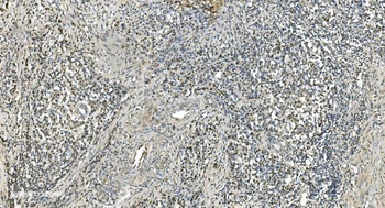 LSM7 Rabbit Polyclonal Antibody