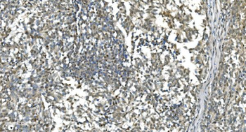 LSM7 Rabbit Polyclonal Antibody