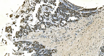 LSM7 Rabbit Polyclonal Antibody