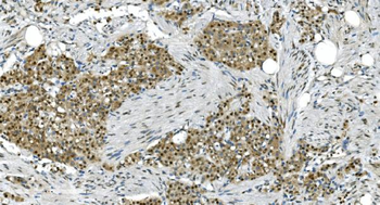 LSM7 Rabbit Polyclonal Antibody