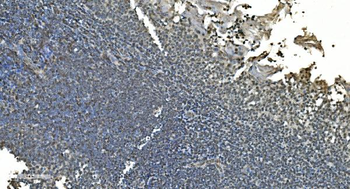 LSM8 Rabbit Polyclonal Antibody