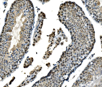 LSM8 Rabbit Polyclonal Antibody