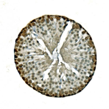 LSM8 Rabbit Polyclonal Antibody