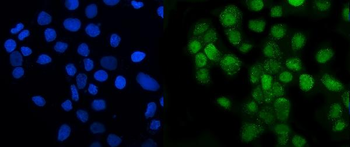 LSM8 Rabbit Polyclonal Antibody