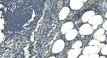 LSM8 Rabbit Polyclonal Antibody