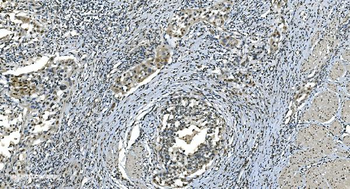 LSM8 Rabbit Polyclonal Antibody