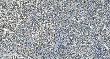 LSM8 Rabbit Polyclonal Antibody