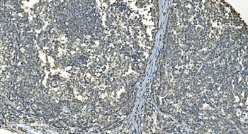 LSM8 Rabbit Polyclonal Antibody