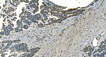 LSM8 Rabbit Polyclonal Antibody