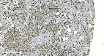 LSM8 Rabbit Polyclonal Antibody