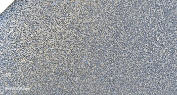 LSM8 Rabbit Polyclonal Antibody