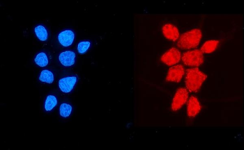NDUFB5 Rabbit Polyclonal Antibody