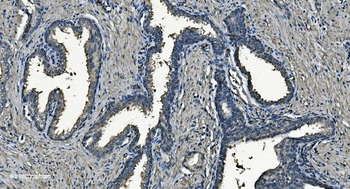 NDUFB5 Rabbit Polyclonal Antibody