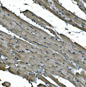 NDUFB5 Rabbit Polyclonal Antibody