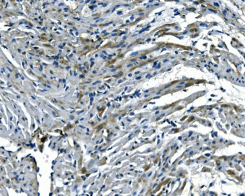 NDUFB5 Rabbit Polyclonal Antibody