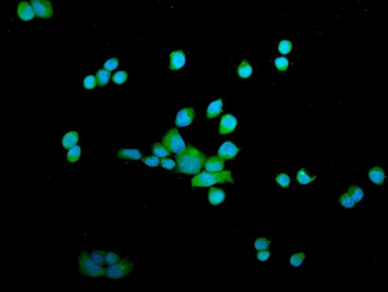 OTULIN Rabbit Polyclonal Antibody