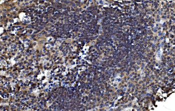 OTULIN Rabbit Polyclonal Antibody