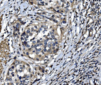 OTULIN Rabbit Polyclonal Antibody