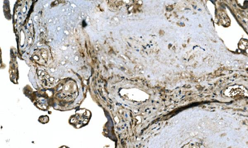 OTULIN Rabbit Polyclonal Antibody