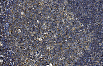 OTULIN Rabbit Polyclonal Antibody