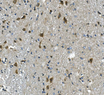 PAR4/Pawr Rabbit Polyclonal Antibody