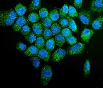PINK1 Rabbit Polyclonal Antibody