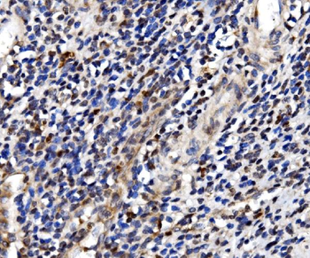 TBP-1/PSMC3/TBP Rabbit Polyclonal Antibody