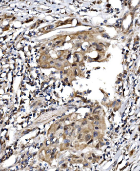 TBP-1/PSMC3/TBP Rabbit Polyclonal Antibody
